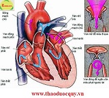 Triệu chứng bệnh tim mạch